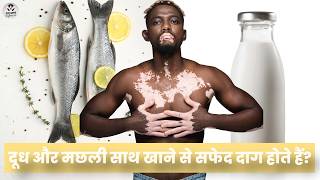 दूध और मछली साथ खाने से सफेद दाग होते हैं? सच या अफ़वाह! Vitiligo Myths @FitnessFighters