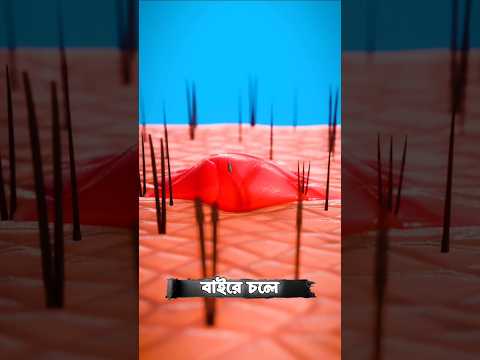 শরীরে কাঁটা ঢুকে গেলে কী হয়? 😱