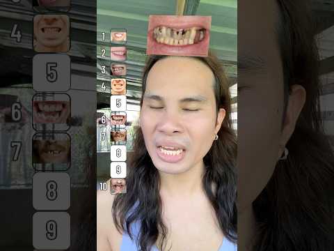 Ranking Teeth in 1 Minute