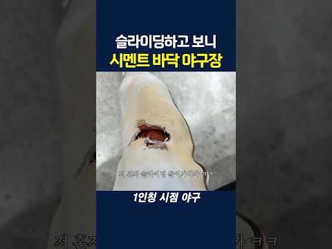 야구장 이렇게 두면 위험합니다