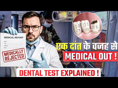 Dental Check ने सब कुछ बिगाड़ दिया !! Complete Dental 🦷  Procedure for SSB Medical !! #ssbinterview