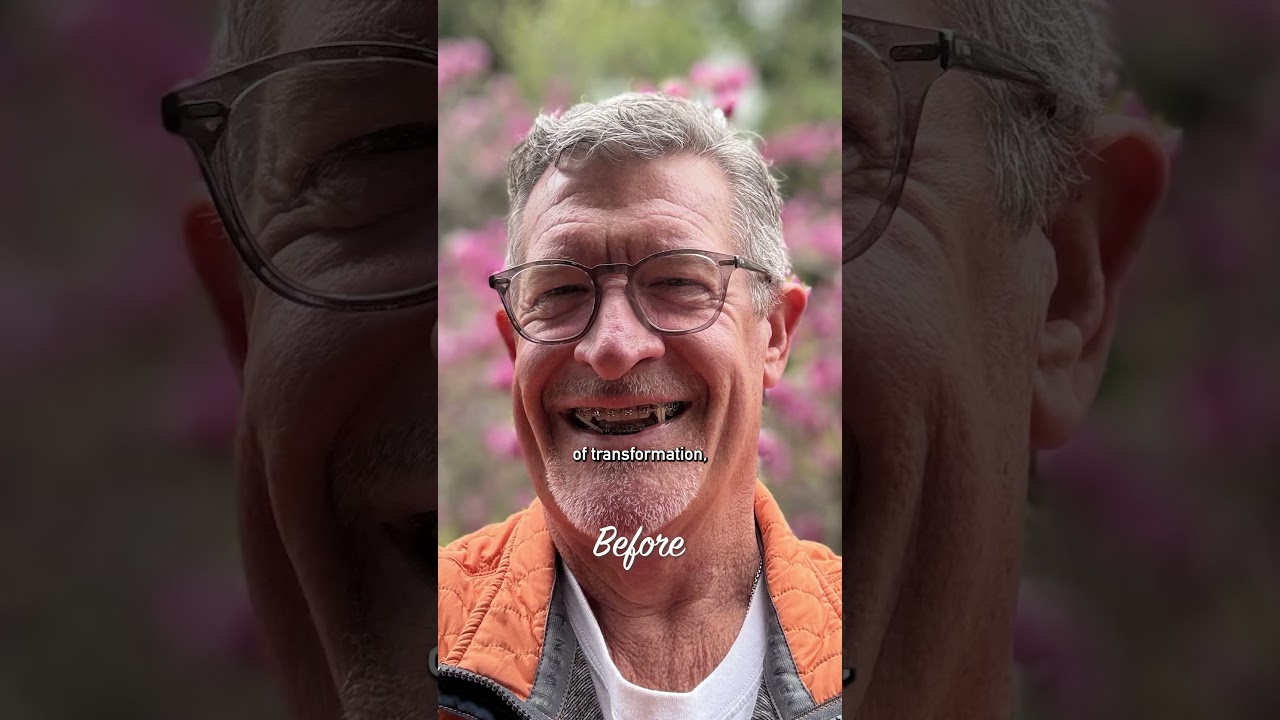 Smiling man with glasses before transformation.