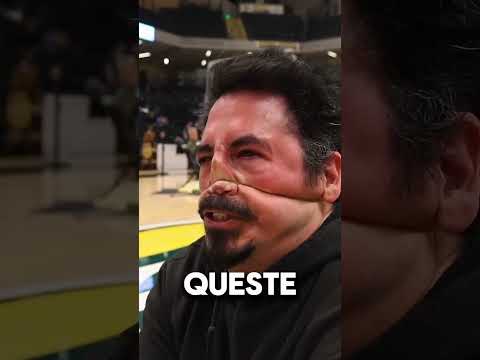 Uno Sport Strano e DOLOROSO