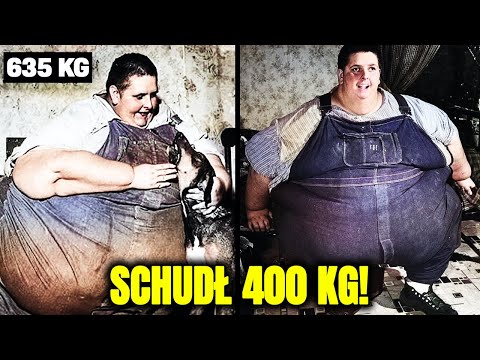 Najcięższy Człowiek w Historii Schudł 400 kg, Ale Za Jaką Cenę!