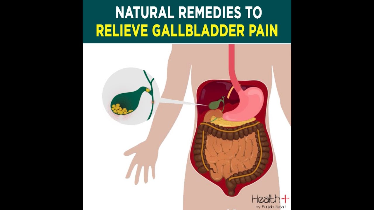 Natural Remedies to Relieve Gallbladder Pain