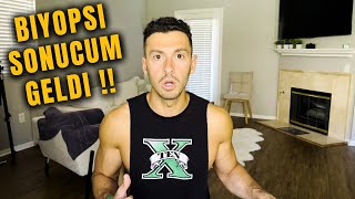 TUMOR iyi huylu, kotu huylu mu SONUC GELDI!! (Bu Surecte Yasadigim Maceralari Anlatiyorum)