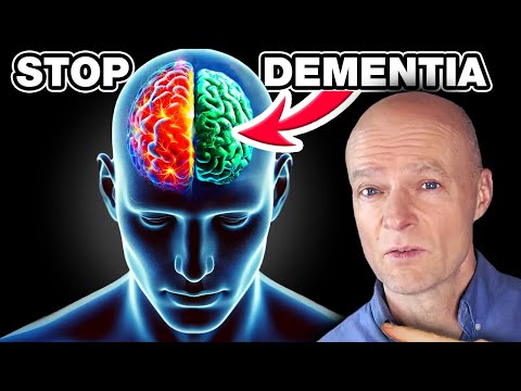 What You MUST Do To NEVER Get Alzheimer’s