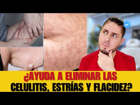 CARBOXITERAPIA DESCUBRE TODOS SUS BENEFICIOS| DOCTOR LEMUS