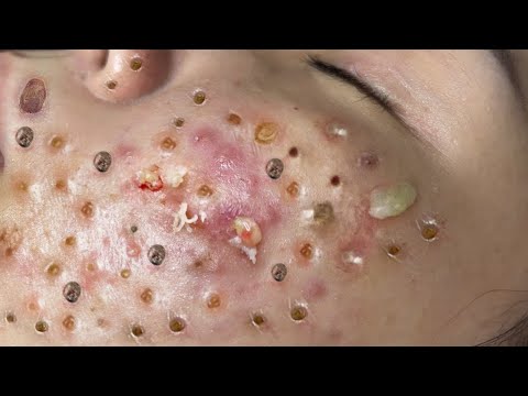 Most Satisfying and Relaxation with An Spa Video #2287
