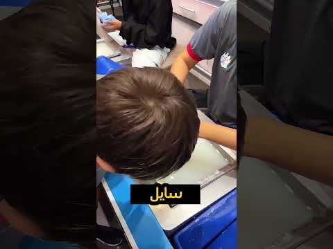 الواد ده عمل ايد بطل خارق