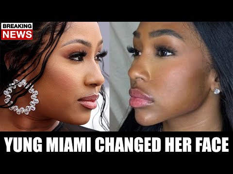 Yung Miami’s New Face is going Viral
