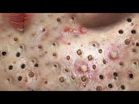 Most Satisfying and Relaxation with An Spa Video #2120