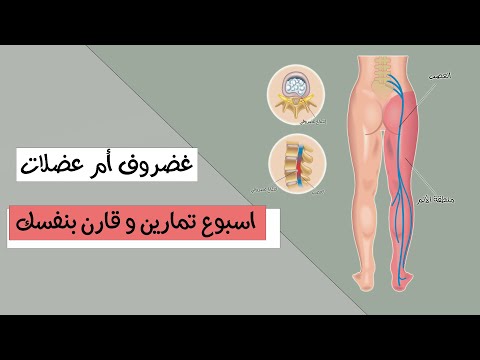 تمارين لتوضيح سبب الألم من اسفل الظهر حتى اسفل الساق - غضروف إلا عضلات؟ رح تتفاجئ بالنتائج