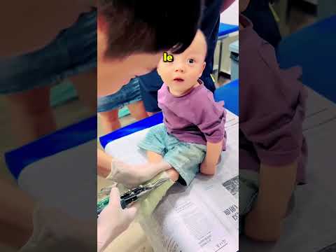 Le médecin a enlevé le plâtre à ce bébé courageux 😱