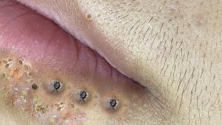 كيفية الحفاظ على نظافة الوجه يومياBT5013