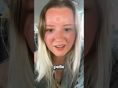 Segnale Precoce Di Un Problema Al Cuore…☠️