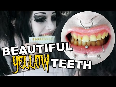 My Yellow Teeth! Whitening Them? | Black Friday