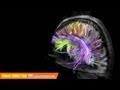 Understanding the Human Connectome