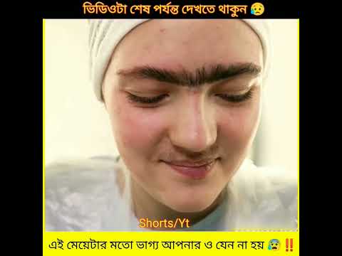 এই মেয়েটার মতো ভাগ্য আপনার যেন না হয় 😥! #shorts #viral #trending #experiment