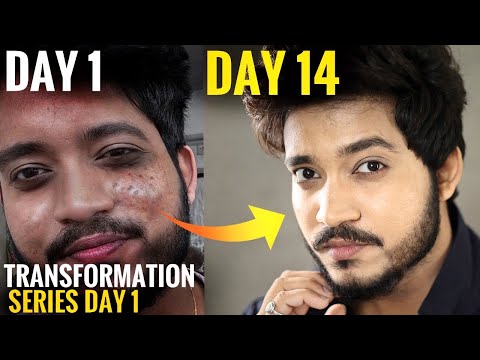 Get Clear & Fair Skin Fast | Day 1 Of Transformation