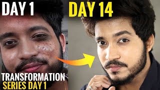 Get Clear & Fair Skin Fast | Day 1 Of Transformation