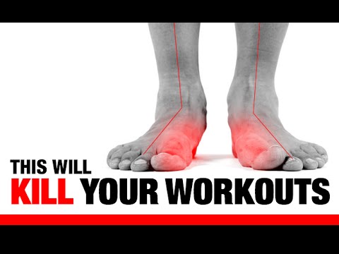 5 Ways Flat Feet -F- Up Your Workouts! (EXERCISES TO FIX THEM)