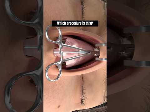 Created by@plastic.touch❌Unauthorized use or reposting of this animation is strictlyprohibited❗️❗️❗️