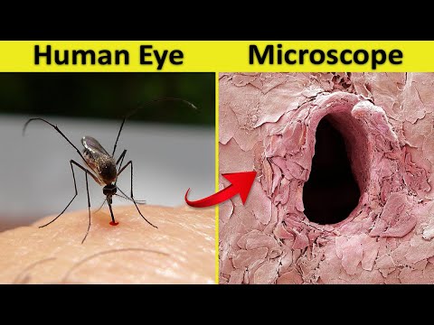 12 Things You Can See Only Under Microscope