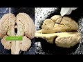 Brain Structure and Function Assessment