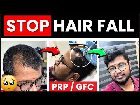 💯சொட்டை விழும் முன் பார்க்கவும் 🤣 | Hair Fall Treatment | Prp | GFC