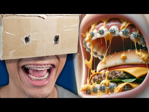 Everything I Ate My First Week With Braces