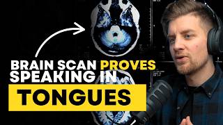 Speaking in tongues: what a medical brain scan revealed.