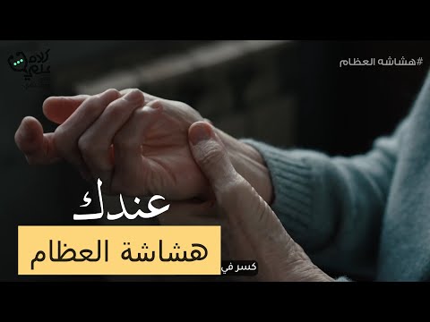 عندك هشاشة عظام 😱