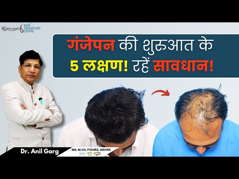 गंजेपन की शुरुआत के 5 लक्षण! रहें सावधान! | 5 Signs You Might Go Bald Soon 😟