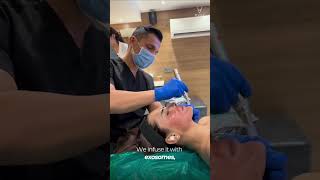 ExoSkin™ for Acne & Aging | Microchanneling With Exosome Skin Treatment | Musk Clinic Ahmedabad