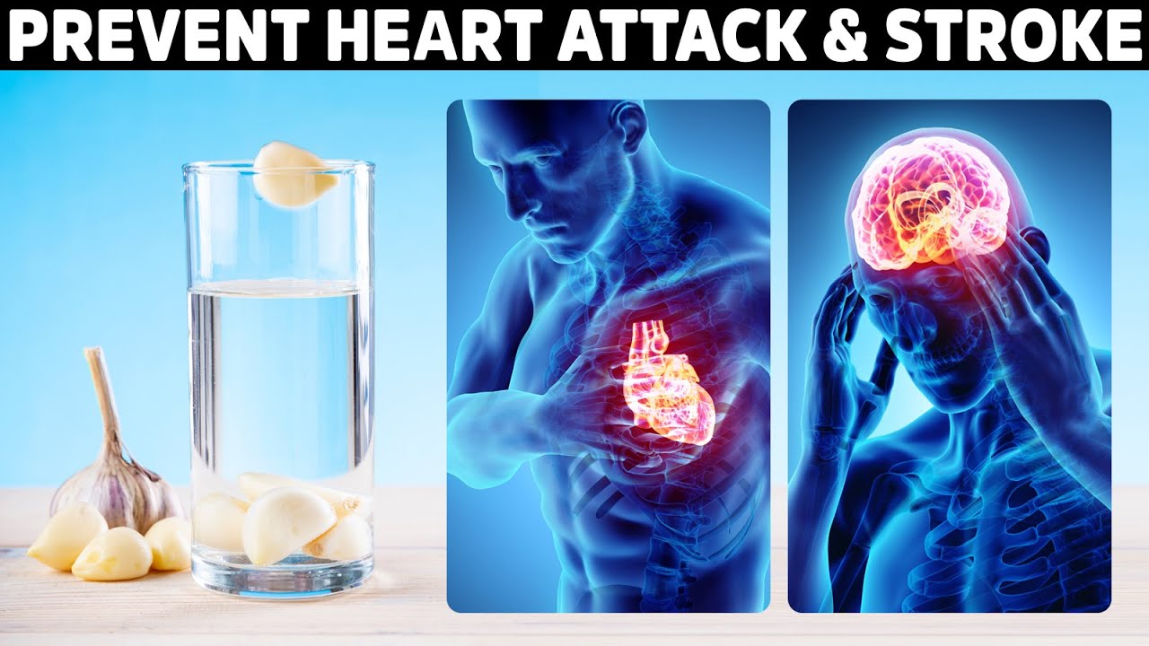 DRINK 1 CUP PER DAY to Prevent Heart Attacks and a Stroke (GARLIC WATER) – Dr. Berg￼