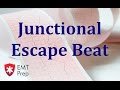 Junctional Escape Beats Characteristics