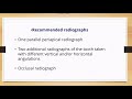 Intrusive Luxation Management and Outcomes