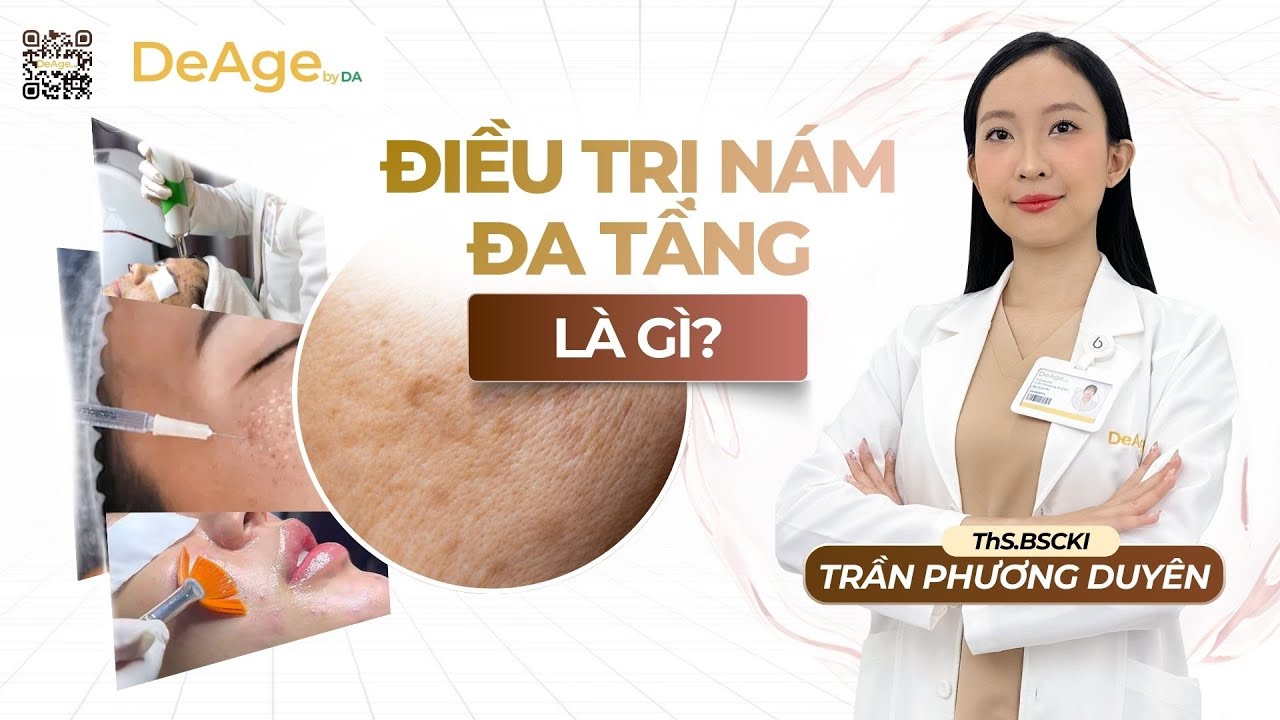 Tranexamic acid trong điều trị nám và những điều cần biết trước khi bắt đầu 6