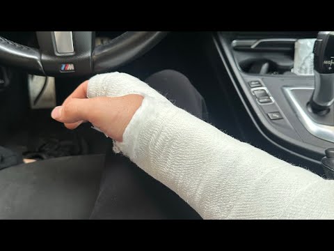 LAST VIDEO! I BROKE MY HAND😒