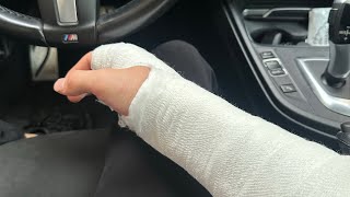LAST VIDEO! I BROKE MY HAND😒