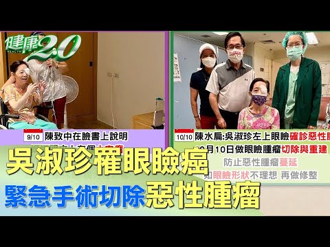 吳淑珍罹眼瞼癌 緊急手術切除惡性腫瘤 健康2.0