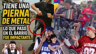 Reveló su pierna hidráulica… y todos en el barrio quedaron en shock