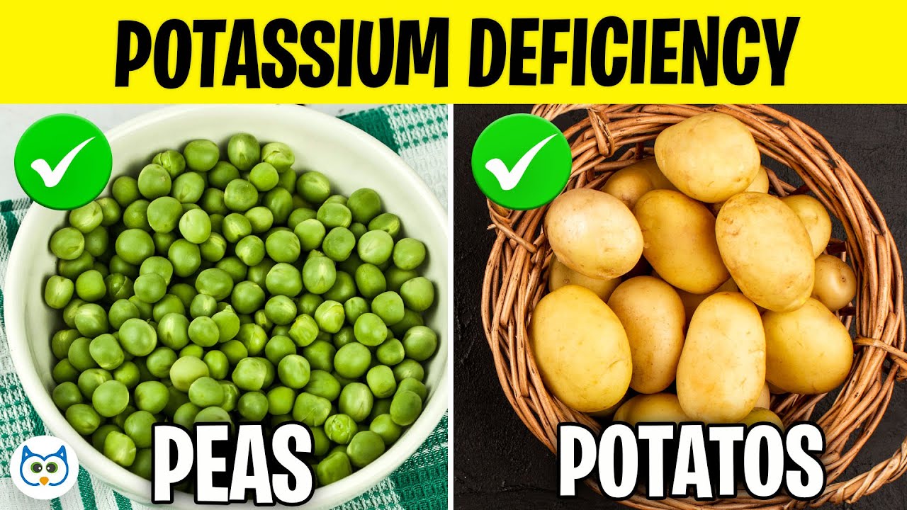 10 Best Foods To Eat If You Have a Potassium Deficiency