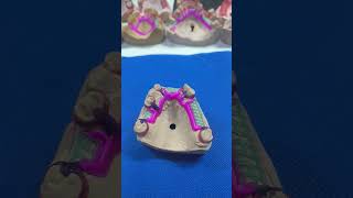 ceroplastia