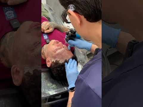 'Tatuagem no rosto? CANCELA!" Part. 2 | Remoção de Tatuagem