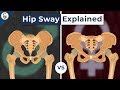 Anatomical Differences in Pelvis and Hip