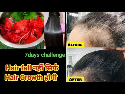 "winter hair care routine" खोए हुए बालों को वापस उगाने के लिए fallow करें ये hair growth toner