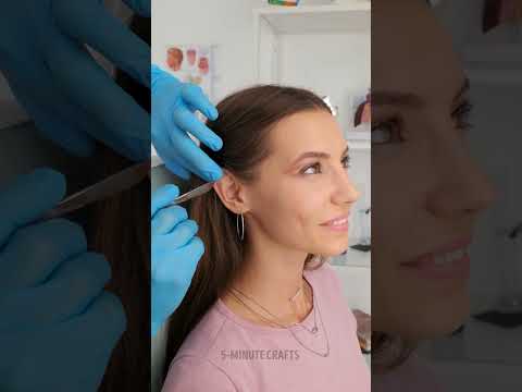Human Body Surgeries You’ll Find Surprisingly Interesting 😮