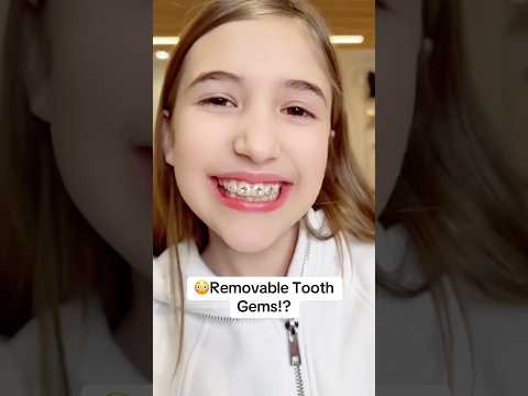 🤷🏻‍♂️Would y’all wear this retainer? 💎 #braces #retainers #toothgems #orthodontist #orthodontics